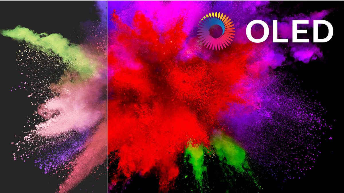 صفحه نمایش اولد تلویزیون فیلیپس OLED854